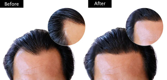 The-10-Benefits-of-AryuSutra-Herbal-Hair-Oil Aryusutra Herbal