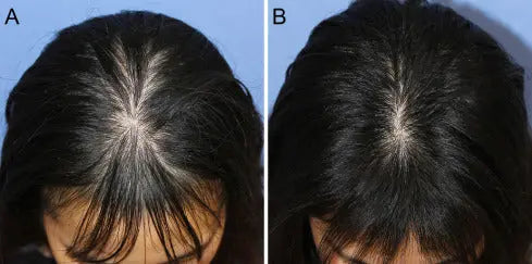 Adivasi Ayurvedic Hair Oil for Hair Growth | Control Hair loss & Dandruff | - Aryusutra Herbal